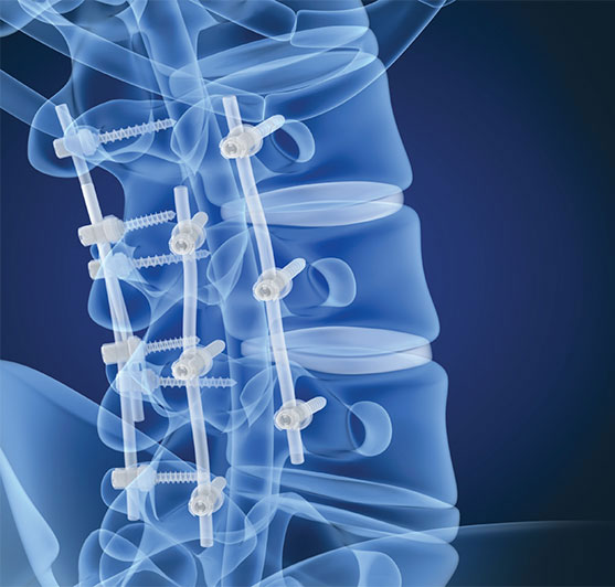 Ground Stainless Steel Bar - Image 6